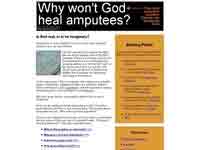 Why Wont God Heal Amputees?
